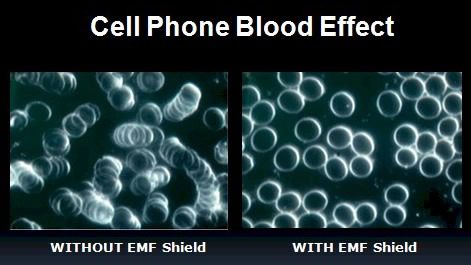 Cell-phone-blood-test